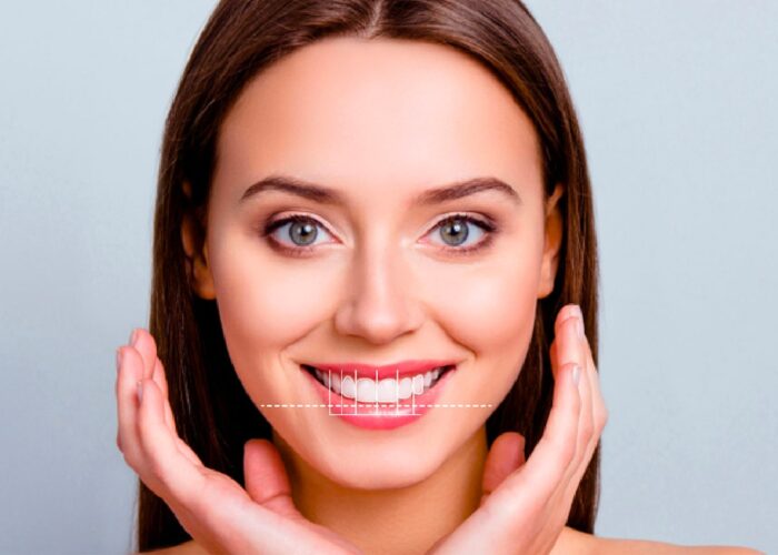 Galeria-Dental-House-03_0007_diseno de la sonrisa-min Galeria-Dental-House-03_0007_diseno de la sonrisa-min